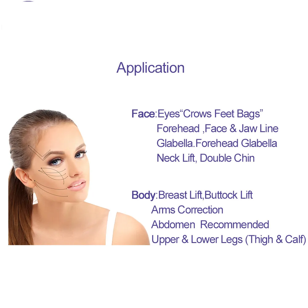 Korea new aqulift cog polydioxanone suture v line pdo thread lift needle Tornado screw 26G 60mm