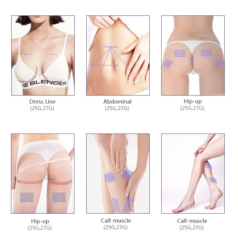 Hot-selling TOP-Q Medical Cog 2-1 Hios Pdo Thread Tensores Facial Nose Lifting Fio Yarn Barb