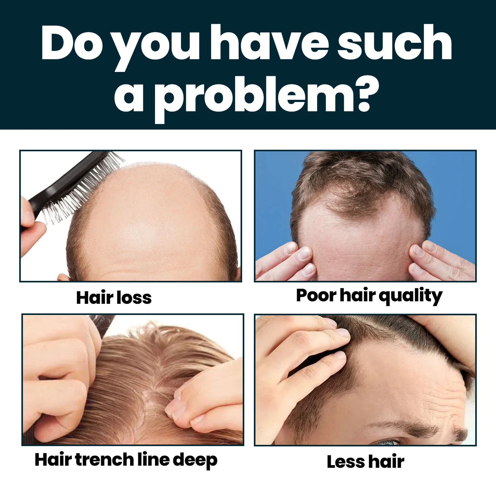 2024 Breakout product 60ml *3 bottles of Anti-hair loss Rapid HairGrowth Oil Hair Regeneration Treatment Serum for women and men