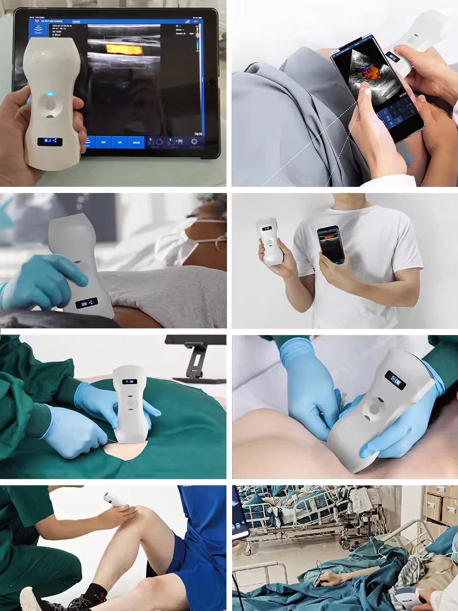 Emergency Ultrasound Device