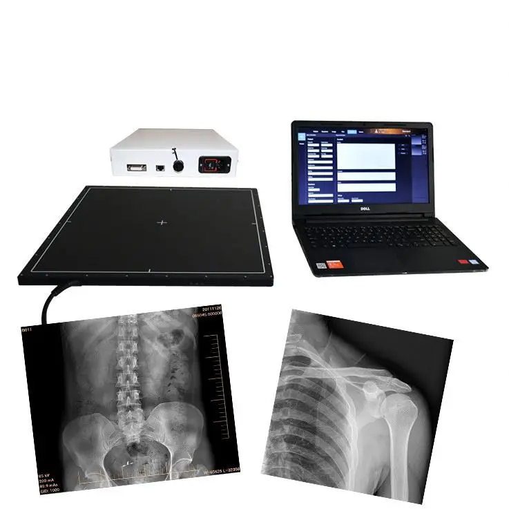 China veterinary or human use flat panel DR detector for digital X ray machine upgrade DR
