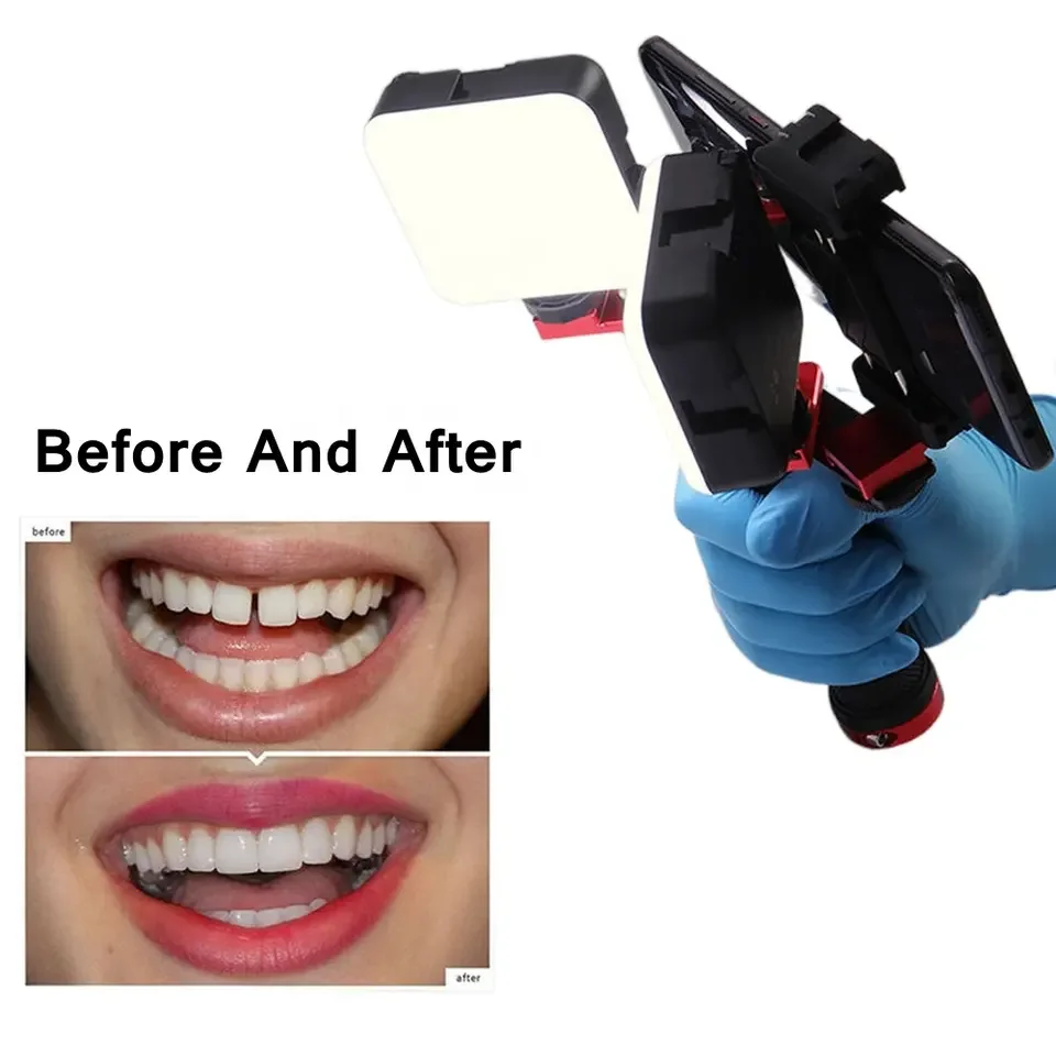 Dentist Tool Mobile Phone Dental Photography Light Flash Photography Equipment /Oral Led Flash Filling light
