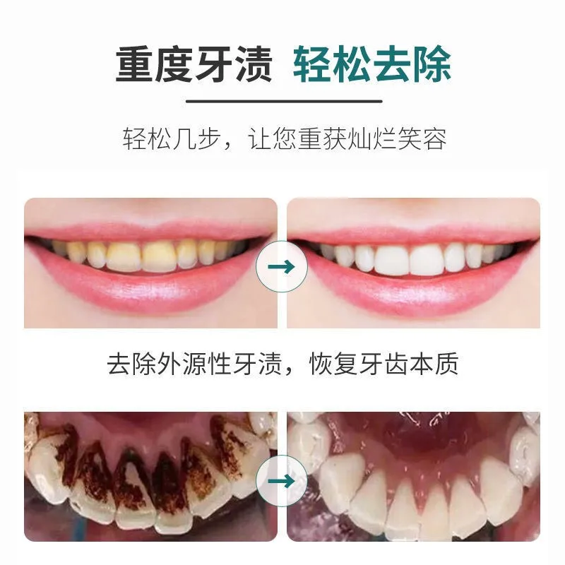 Factory OEM Home Use Mini Cordless Portable waterpick water flosser oral for irrigator