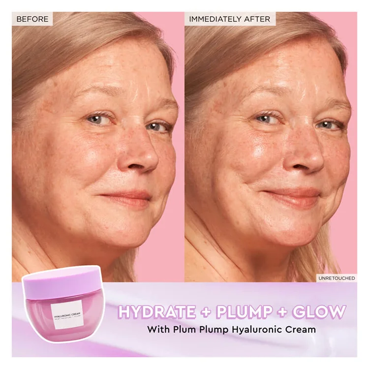 OEM/ODM Organic Firming Moisturizer Anti Wrinkle Face Cream Whitening Hyaluronic Kojic Acid Cream for Women Face Cream