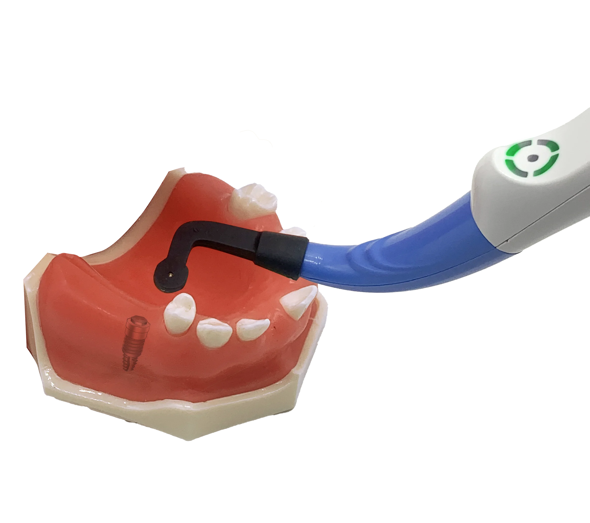 Easyinsmile New Dental Equipment Dental Implant Locator Sensor Implant Screw Detector for Dentist Generation 2