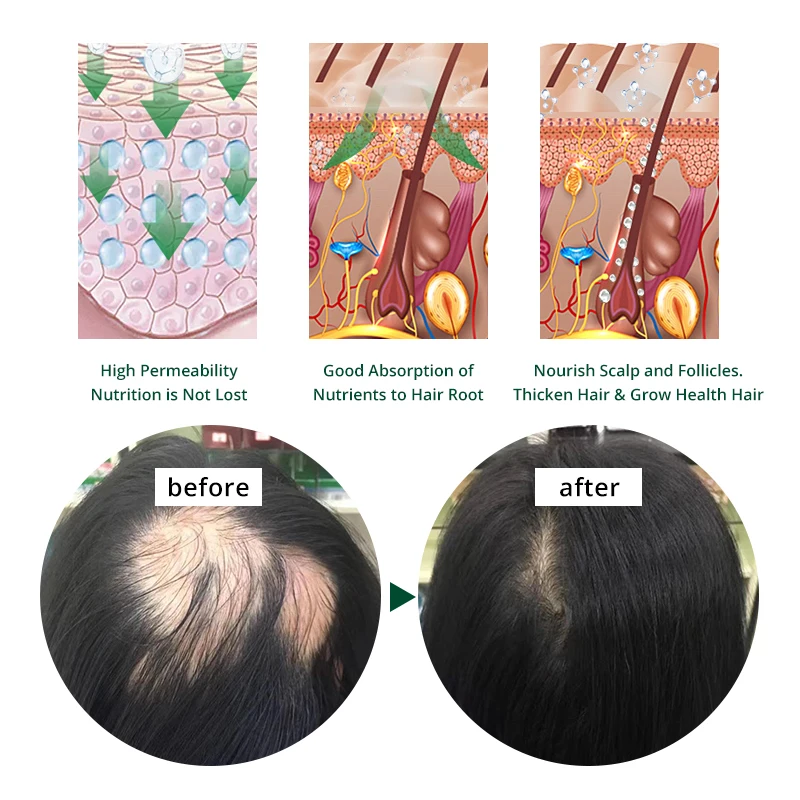 Custom Logo Best Quality Natural Fast Hair Growth Oil for Businessman