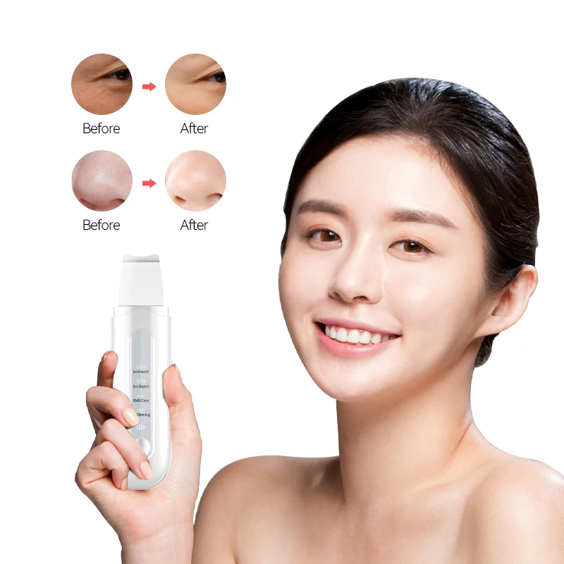 Портативный Ионный ультразвуковой шпатель для лица, пилинг, ультразвуковой скребок для кожи, скребок для лица