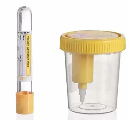 Good quality sterile Urine specimen cup with PET tube Disposable sterile Vacuum Urine Containers