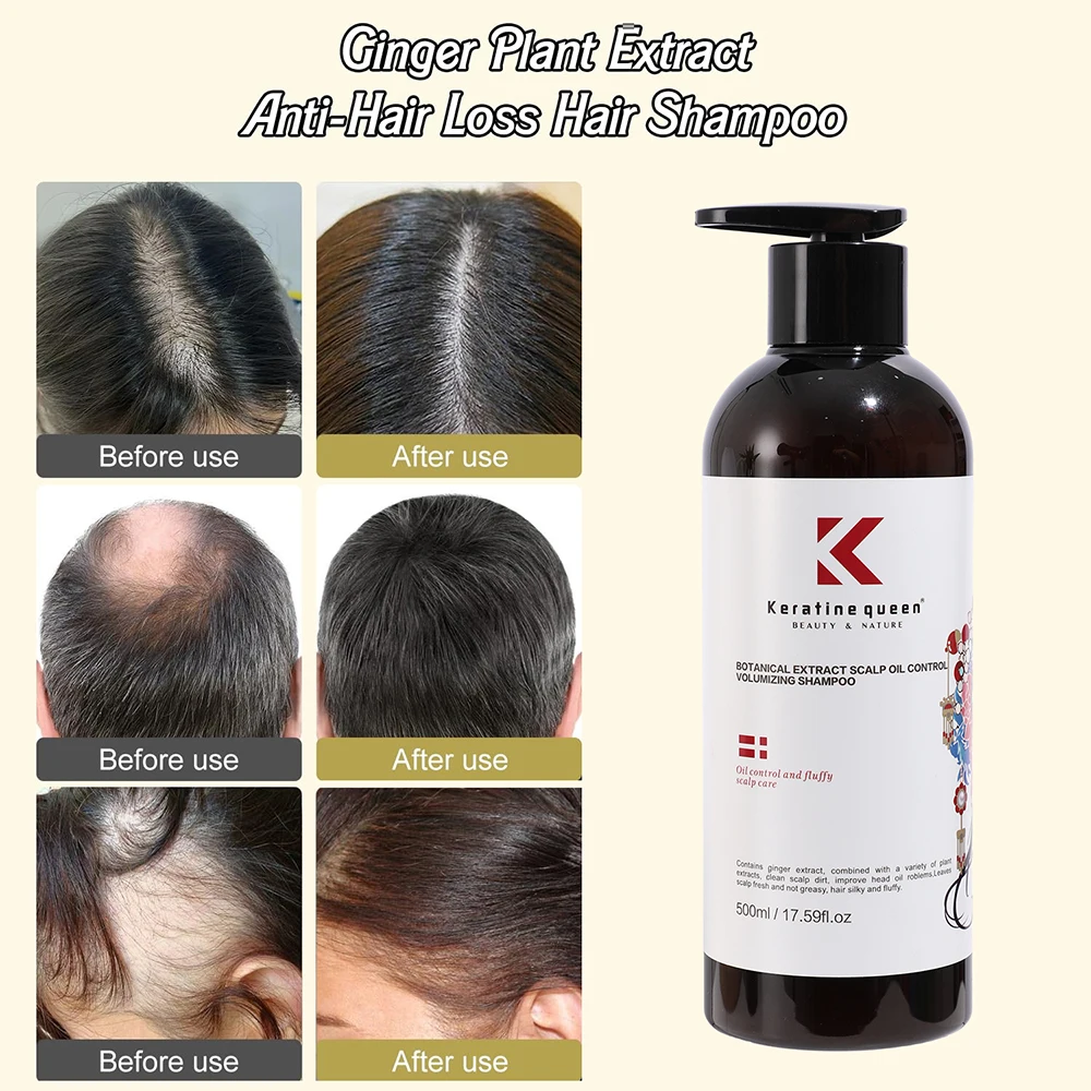 Private Label Anti Hair Loss Products Gigner Shampoo for Hair Fall Treatment