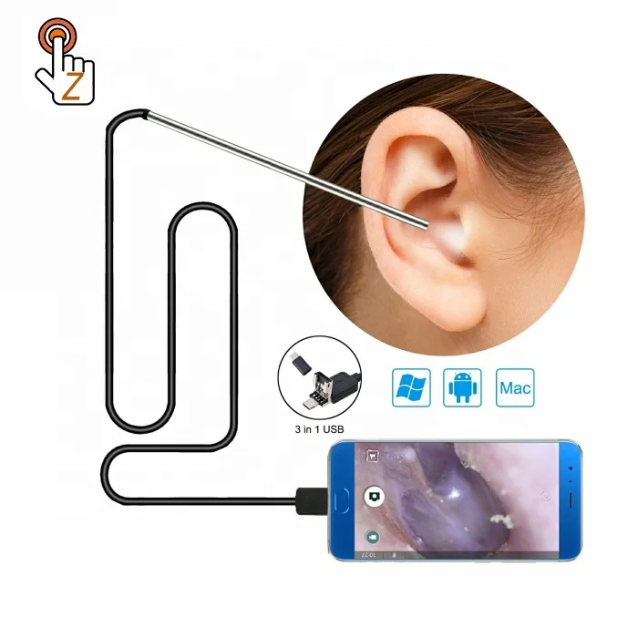 Portable Otoscope Safe Ear Camera Endoscopica Usb 3.9mm Smart Ear Cleaning Camera Endoscopio