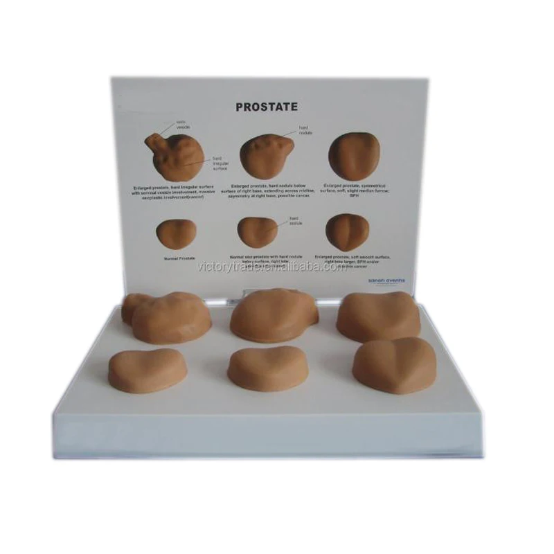 V-AM028 Wholesale human male anatomical pathological prostate model