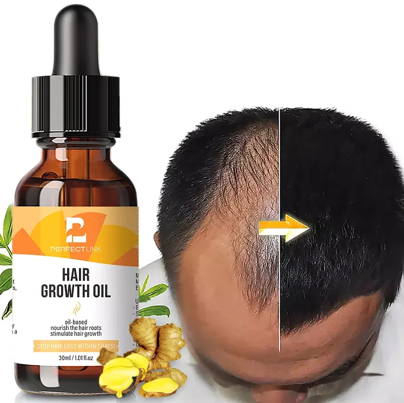 Create Your Label Hair Care  Ginger Smoothing Nourishing Anti Loss Regrowth Scalp Elixirs Private Label Hair Growth Oil Serum