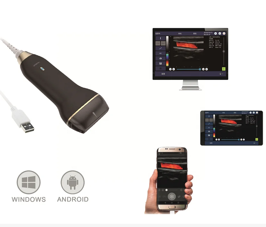 Линейный цифровой мини USB-зонд Healson C30L, цветной доплеровский ультразвуковой аппарат/портативный ноутбук, ультразвуковые цены