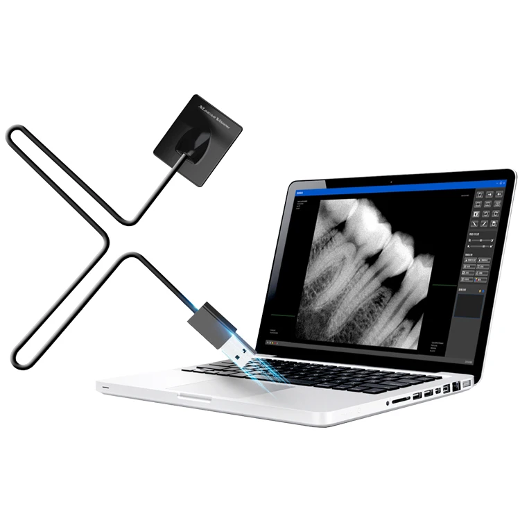 High quality teeth x ray sensor Rvg digital Dental Intraoral x-ray Dental Sensor price