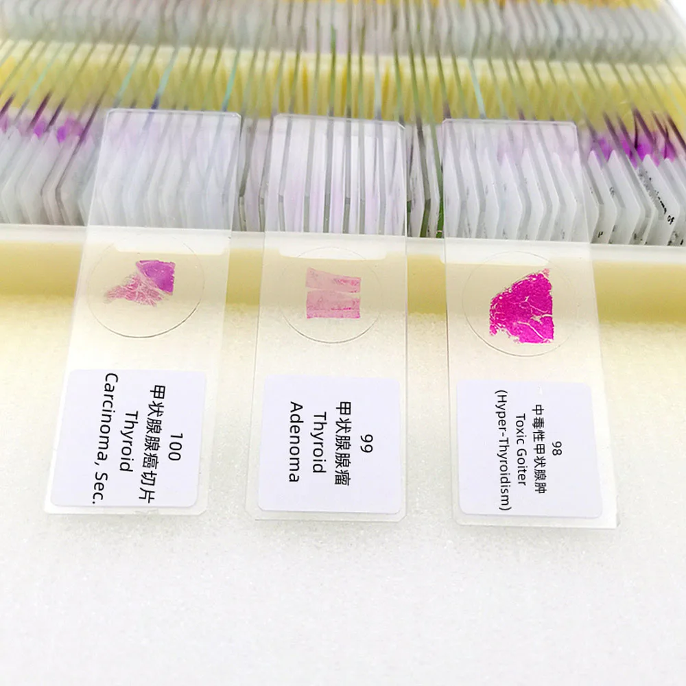 100Pcs Human Disease Pathology Prepared Slides Teaching Prepred Microscope Slides