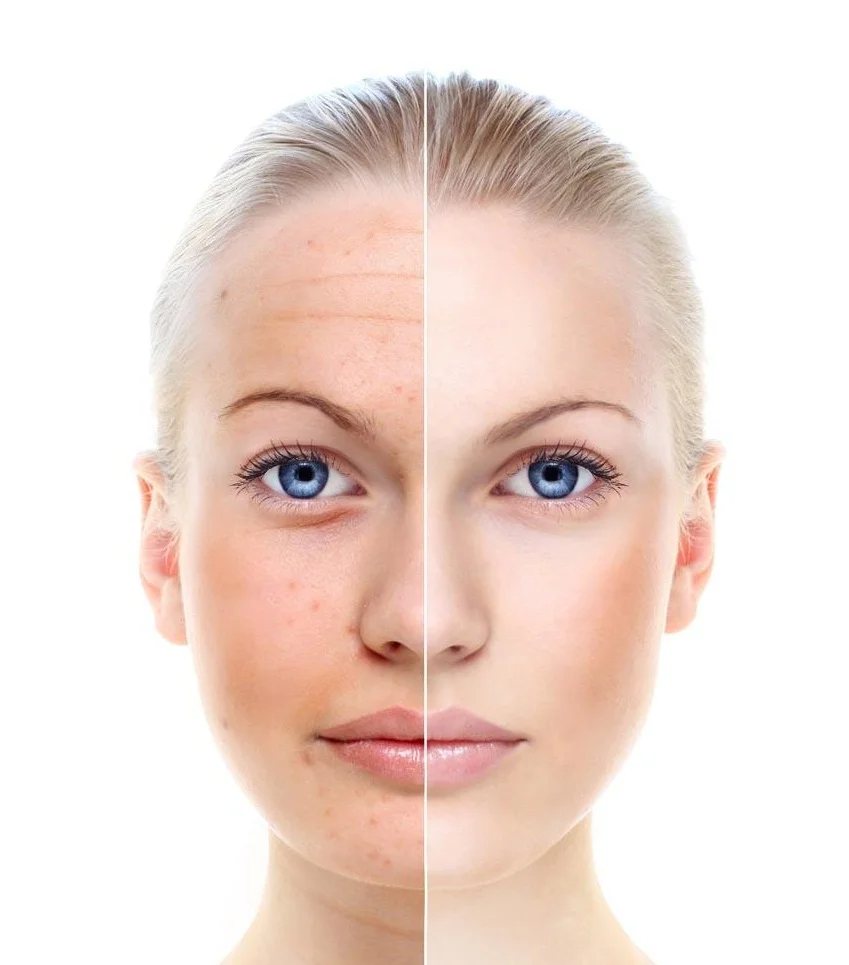 Private Label skin care vc serum anti aging hydra skincare facial microneedling serum natural vitamin c serum for face