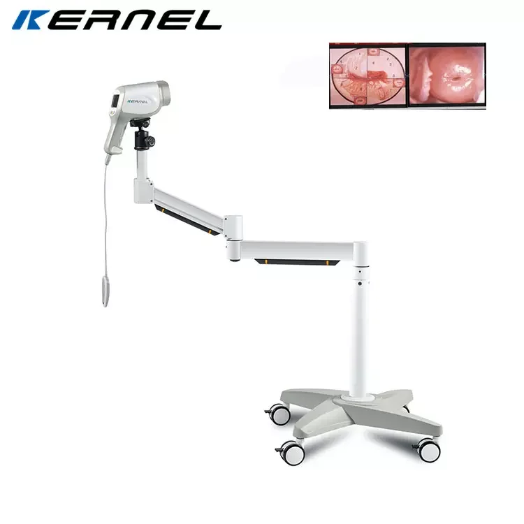 new design high definition COLPOSCOPY colposcope with great price KN-2200 gynecology Cervical Colposcopy Camera