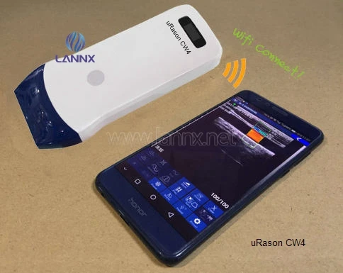 LANNX uRason CW4 Good price Handheld Color Doppler Ultrasound Probe Scanner Support ecografo mini Probe Ultrasound Machine