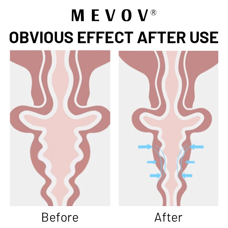 Private Label Tightening Gel Vaginal Shrink Cream Vaginal Gynecological Firming Tightening Gel