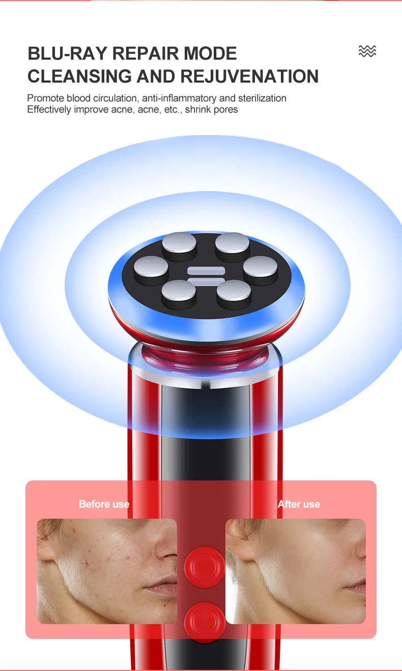 Multi-functional Facial Message Face Lifting Microcurrent RF Beauty Equipment