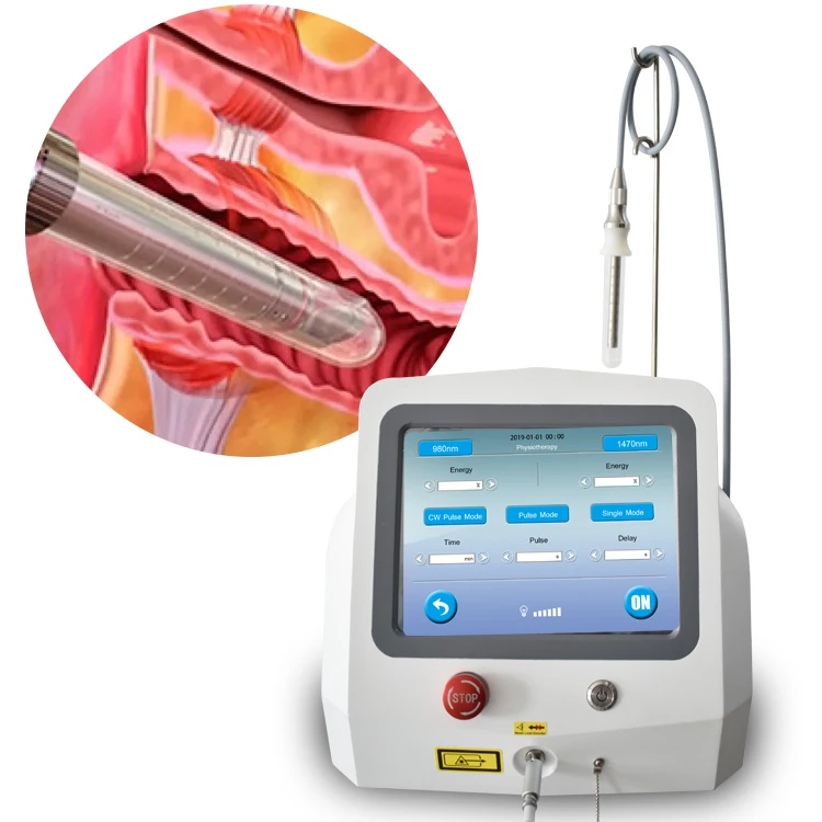 Vaginal Tightening Machine Laser Rejuvenation Vaginal Tightener Gynecology Diode Equipment