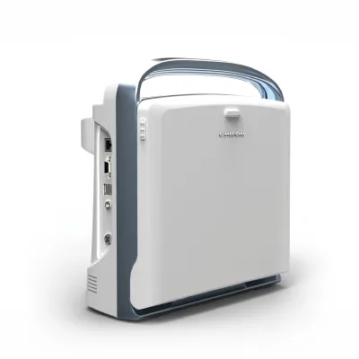 Chison Eco1 Black and white portable Ultrasound Scanner Echo1 veterinary ultrasound Machine  Diagnostic ultrasound