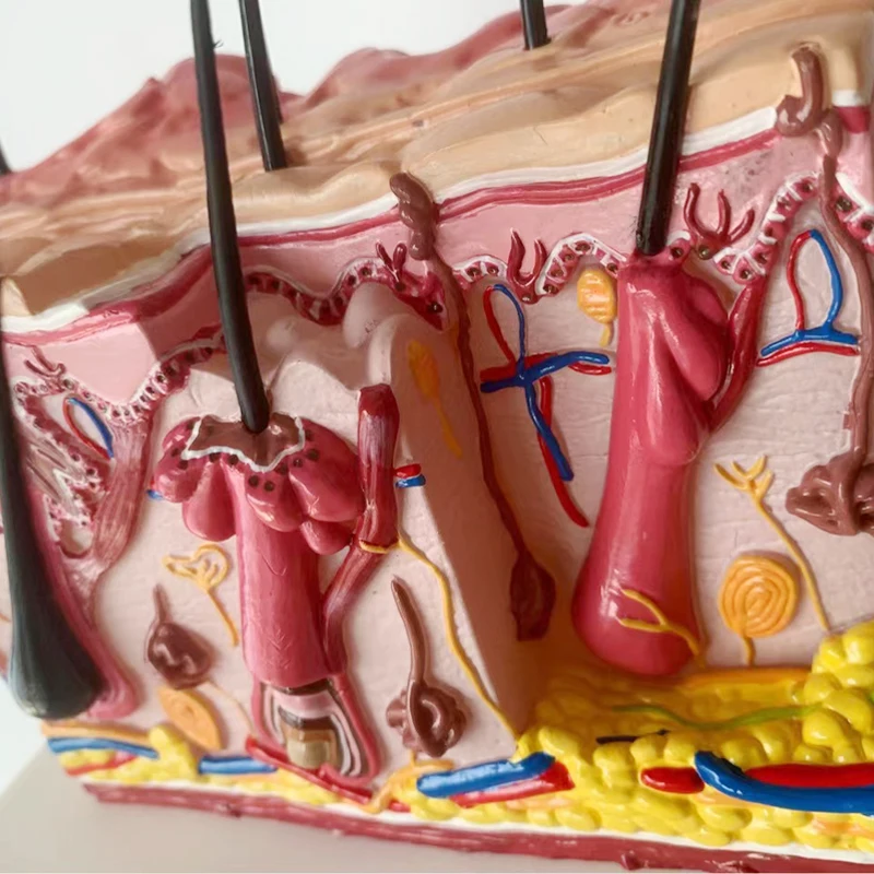 Medical science  biology  pathological skin acne anatomical  structure 3D diseased  model