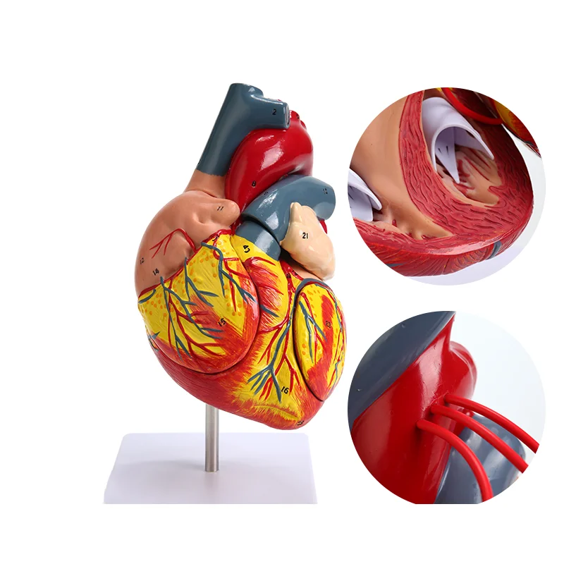 Anatomical Model of Human Heart B Ultrasound Cardiac Model for Medical Teaching