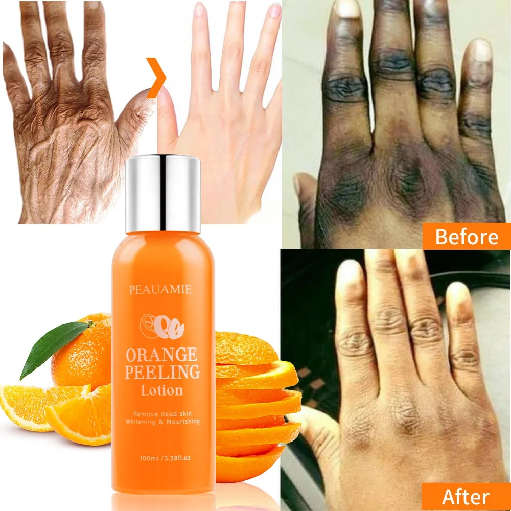 Most Effective Skin Whitening Yellow Peeling Oil Exfoliating Orange Peeling Lotion For Removing Dead Skin