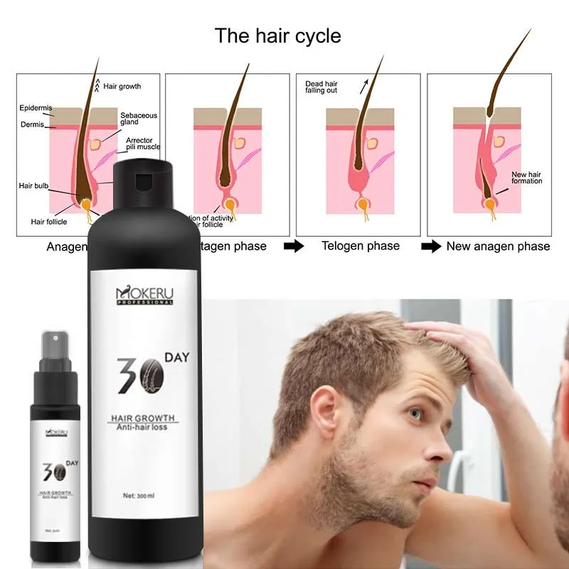 Guangzhou professional hair loss or drop treatment and effective repair specifically for bald or about to be bald people