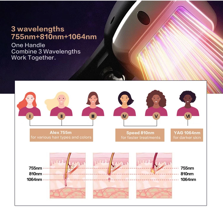 titanium hair laser (1)