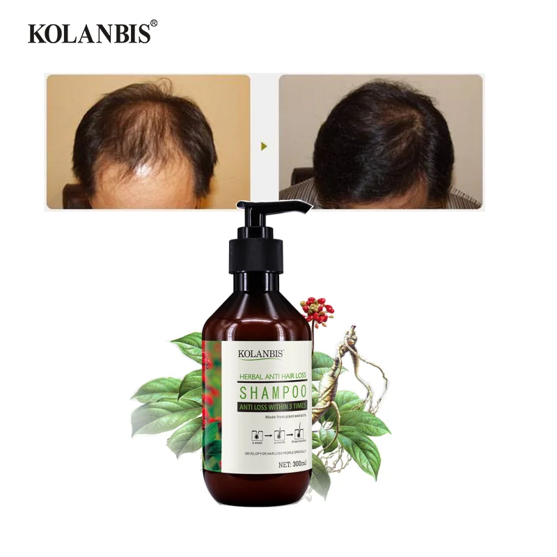 Private Label Chinese Factory Ginger Anti Hair Loss Shampoo Natural Ingredient