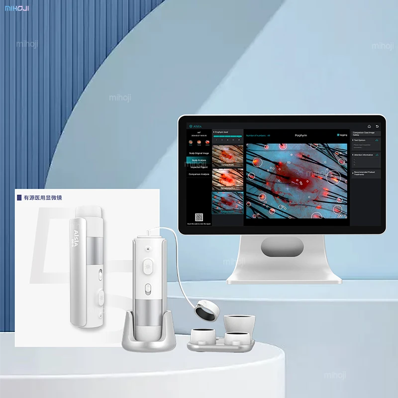 hair growth scalp and hair analysis machine professional scalp analysis