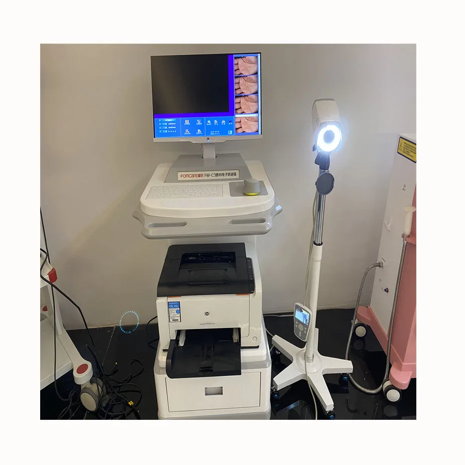 2023 New Design Medical Endoscope Portable Colposcope Digital Video Digital Colposcope For Gynecology