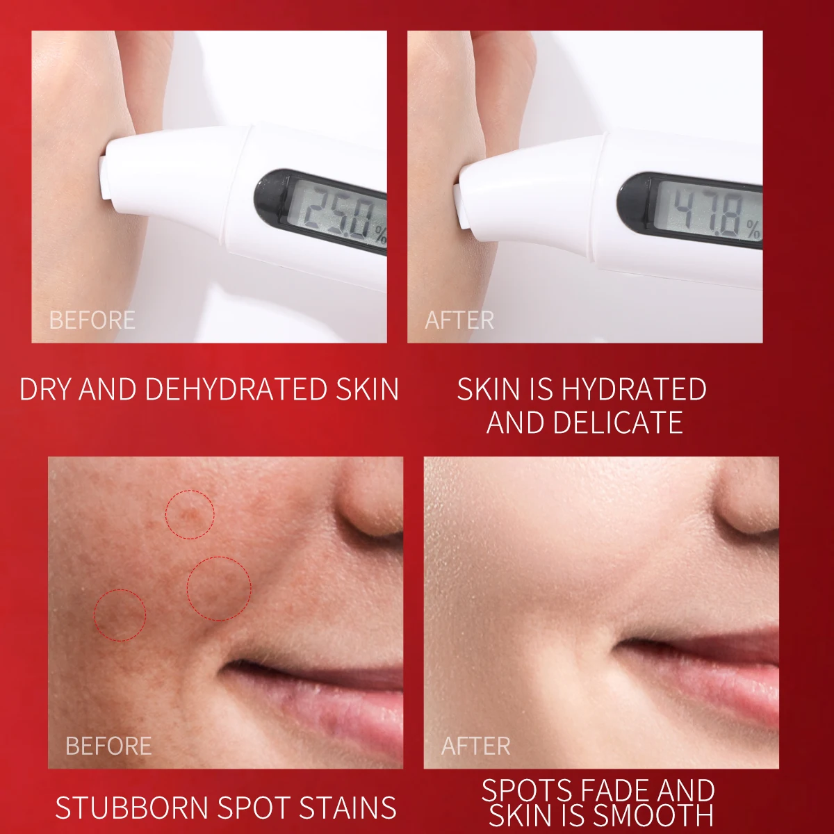 OEM ODM Hot sales Moisturizing  whitening dark spot removing freckle cream