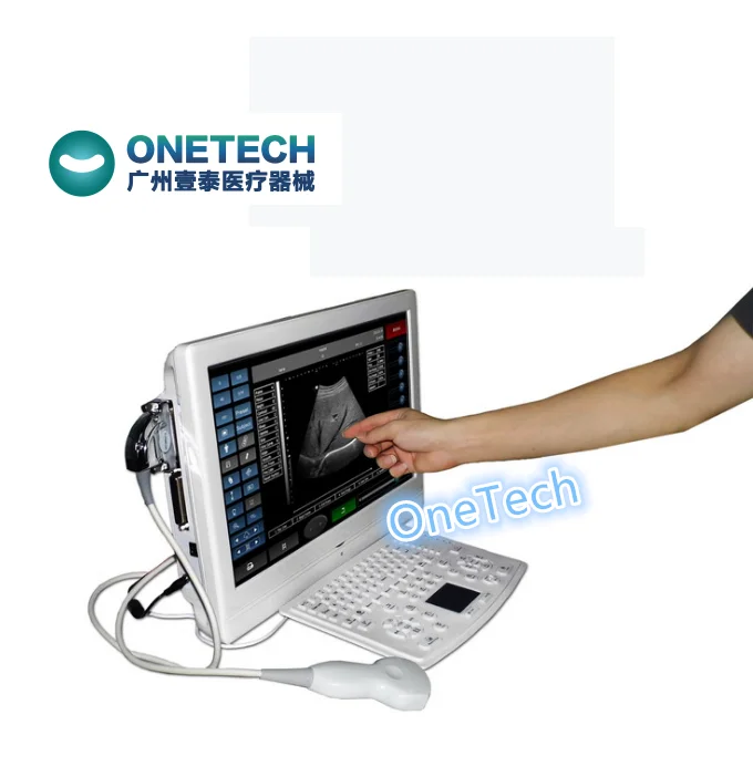 Ультразвуковая машина с сенсорным экраном 18 5 дюйма большим ЖК-дисплеем