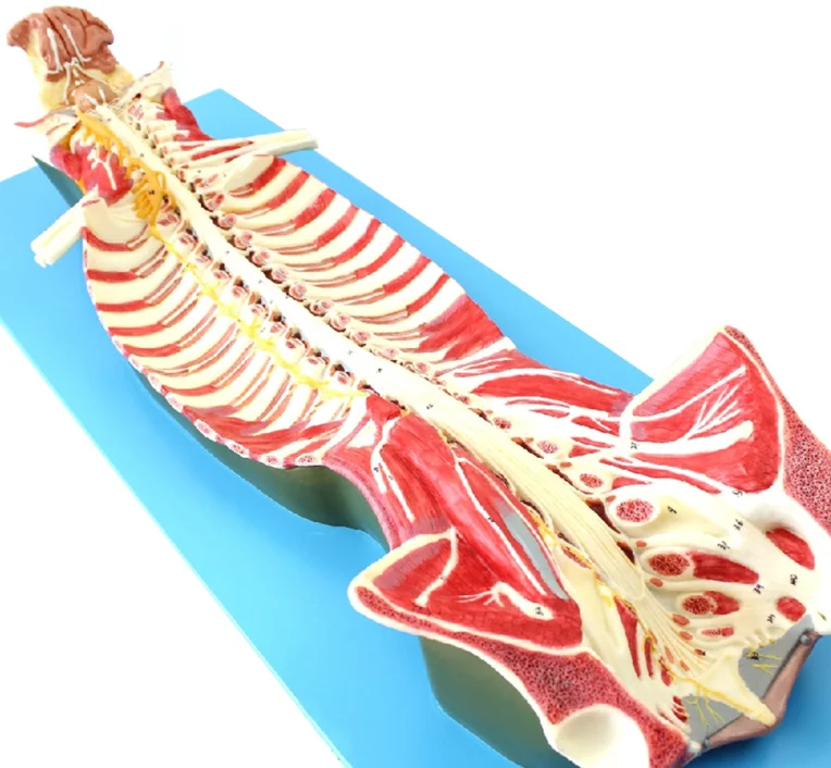 Medical human spine anatomical model spinal nerve anesthesia spinal and lumbar minimally invasive orthopedics model