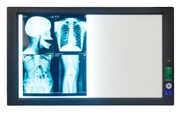HOCHEY MEDICAL Ultra Bright LED Thin Panel Film Negatoscope Led X-ray