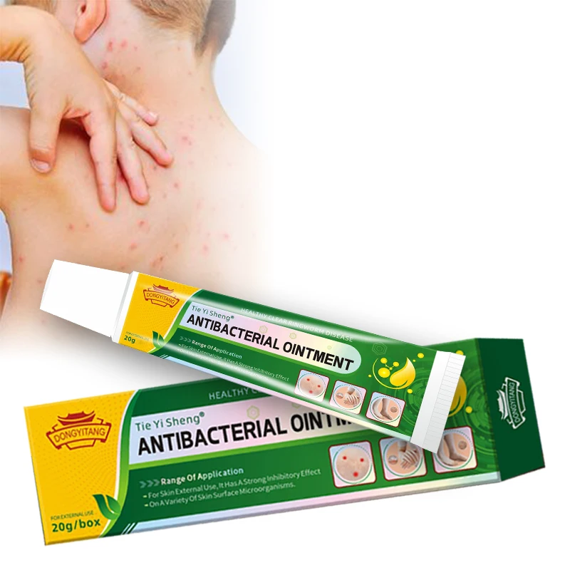 Custom Logo Herbal Green Healthy Skin Care Cream Fungal Infection cream