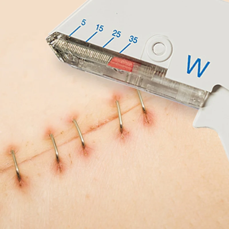 Disposable Medical Wound Closure 35w Skin Stapler single use coalescence of skin stapler removal for skin healing