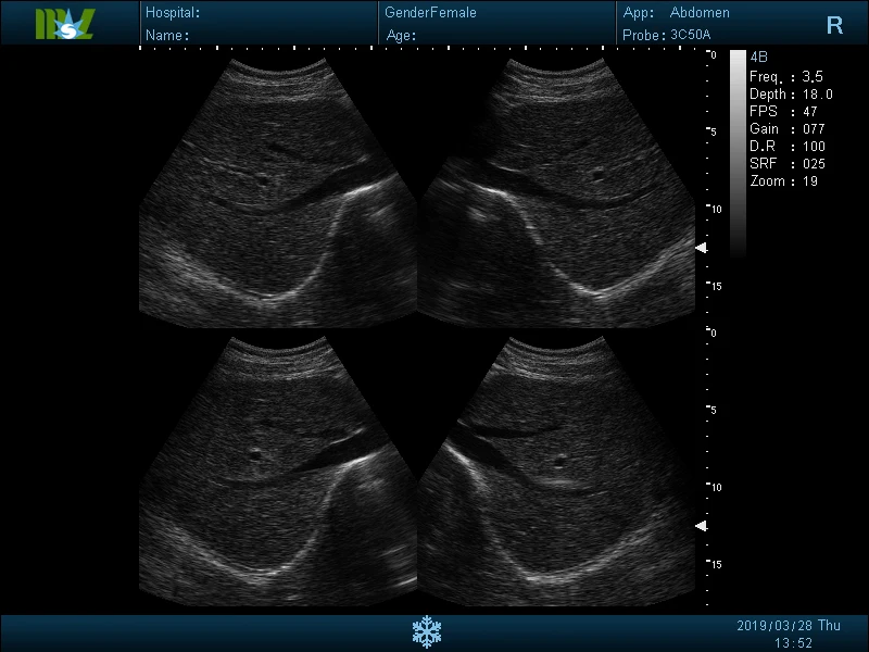 Portable Black and White Vet Ultrasound Scanner Machine Price Ultrasound for Animal