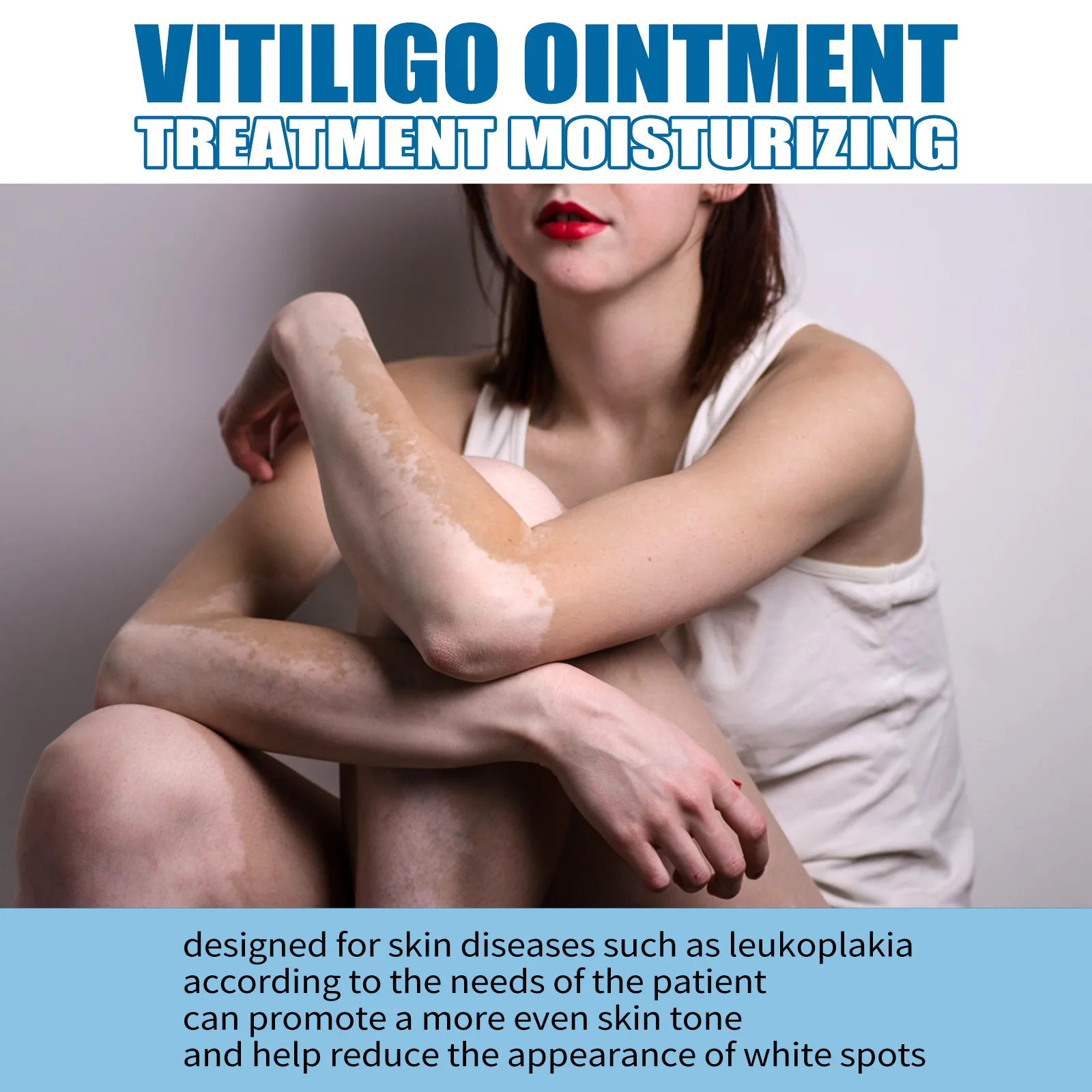Body Care Fade Mottling Even Skin Tone And Lightened Body Spots Vitiligo Treatment Ointment