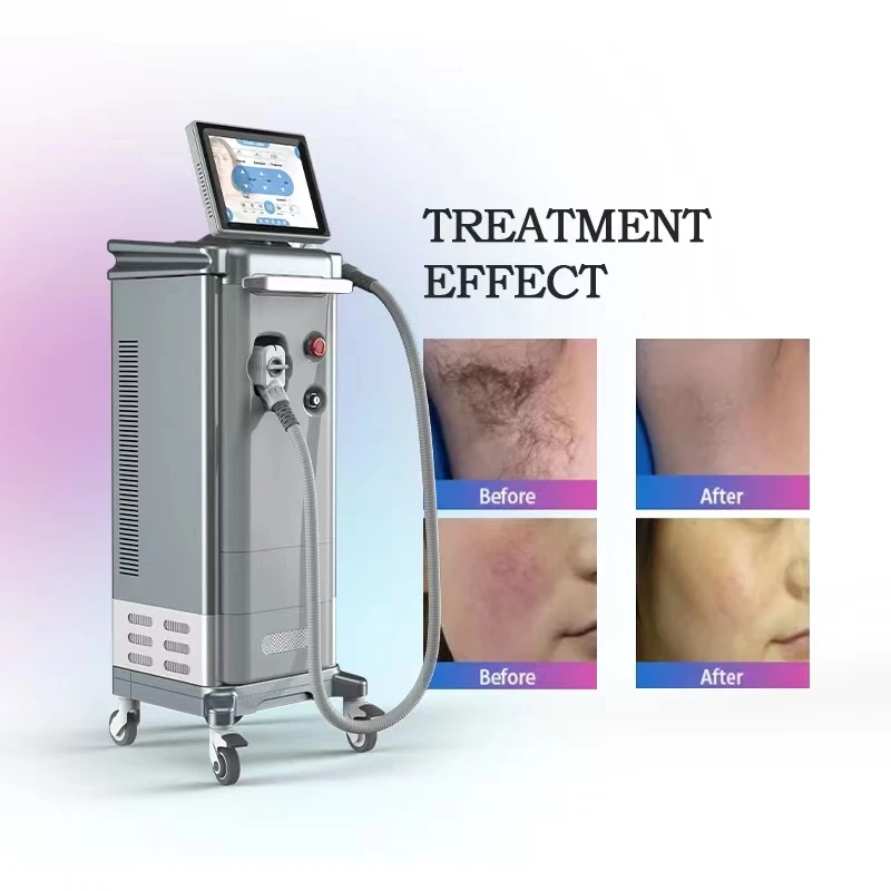 Approval electrolysis machine hair removal 808nm diode laser hair removal machine price for beauty center