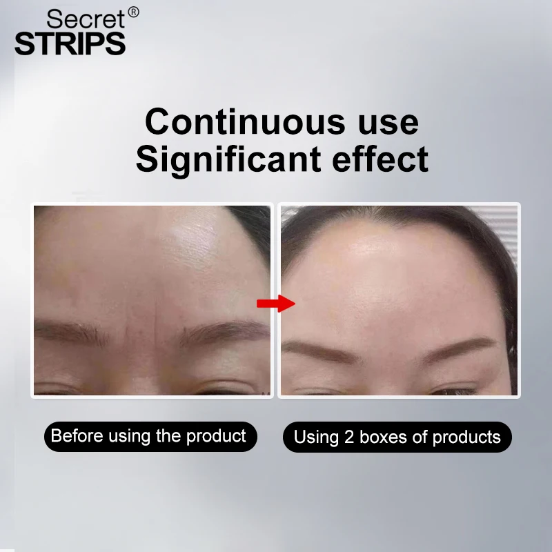 Cosmetic Face Facial Skin Masks Anti Wrinkle Frown Lines Wholesale Facial Mask Anti Frown lines Care Strips