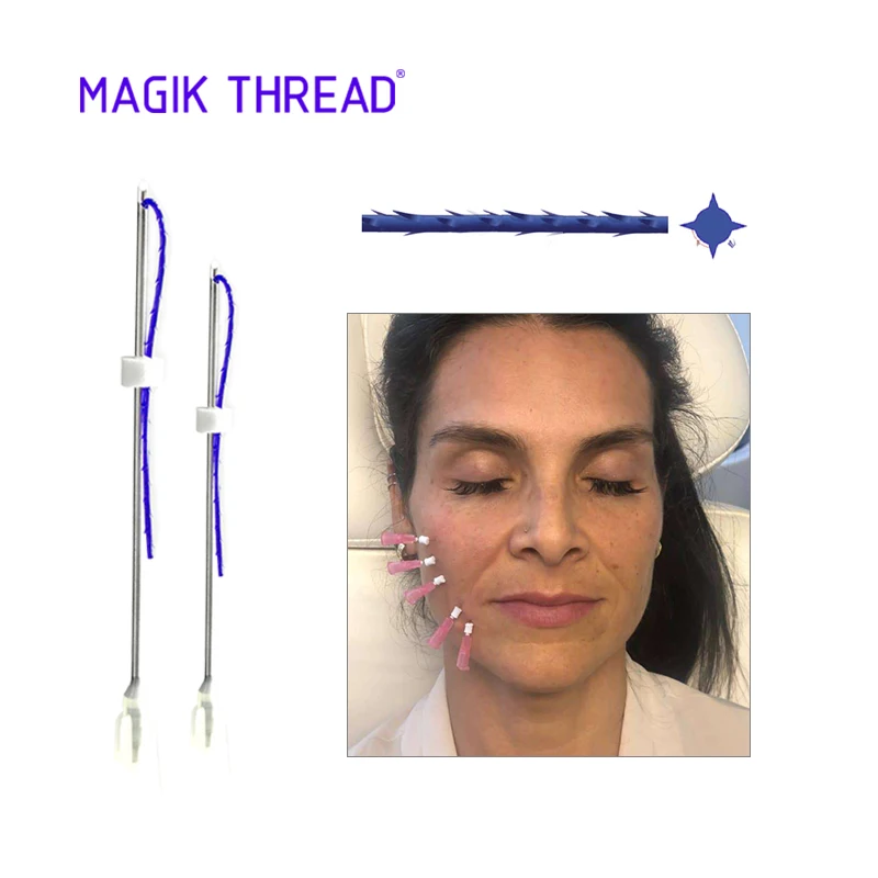  Magik Thread cog 3d 4d 19g 100 мм зазубрина fio nose pdo i силуэт нить лифтинг лица