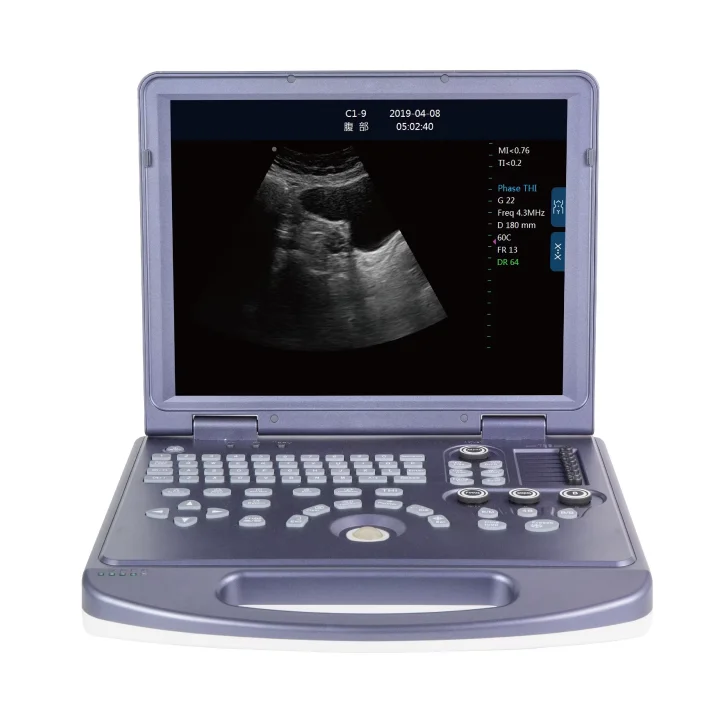 15 inch color LCD display/hard disk 128G/digital veterinary vet medical system dawei dw MU15 ultrasonography medical equipment