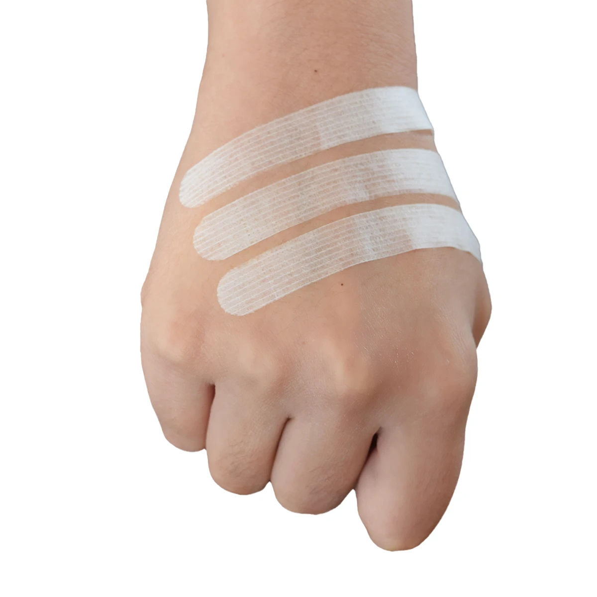 Sterile Adhesive Wound Closure Strips