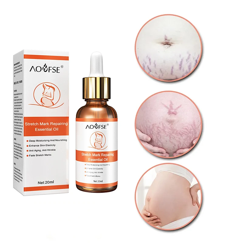 Pure Natural Maternity Skin Care Body Oil Scar Repair Removal Stretch Marks Oil