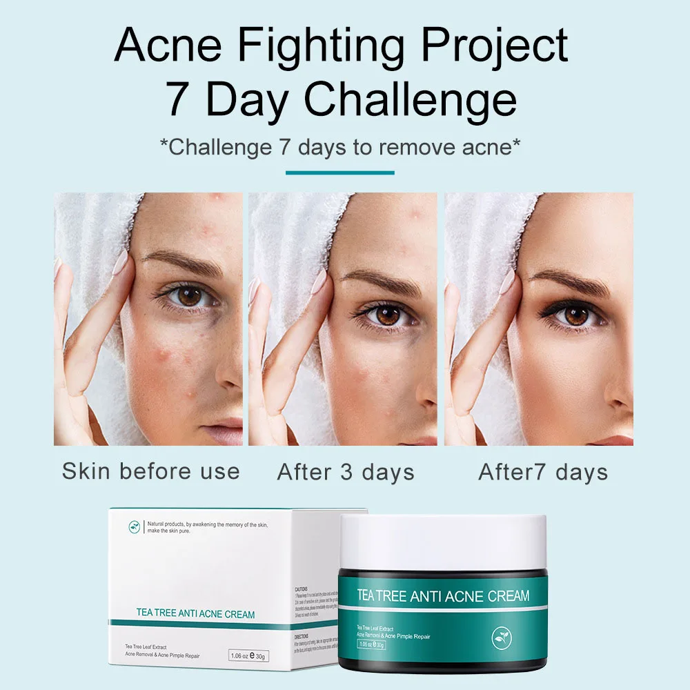 Крем для лечения акне Осветляющий восстанавливающий от и шрамов