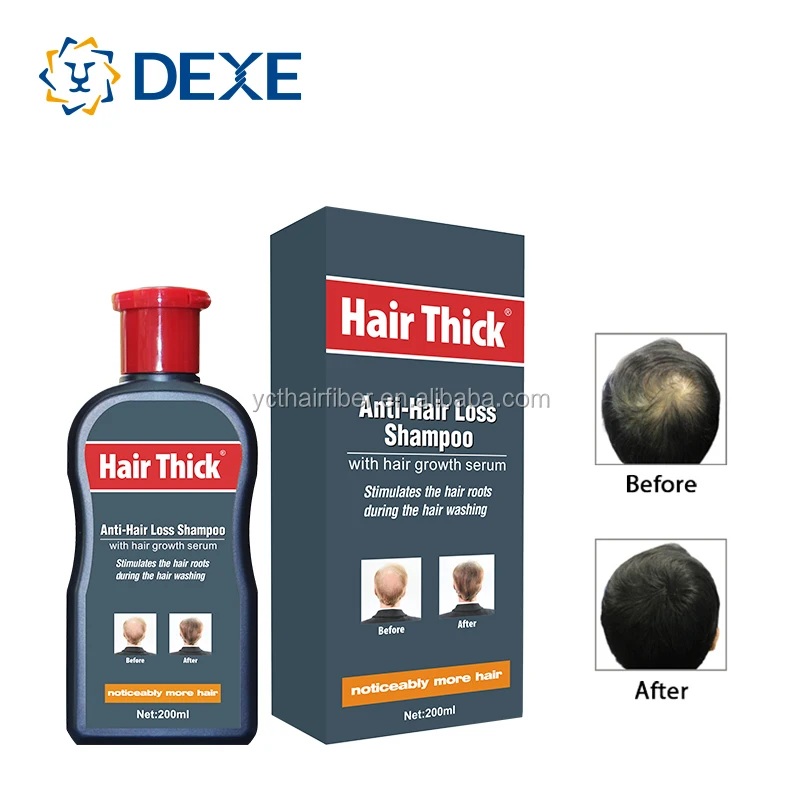 Dexe Anti Hair Loss Shampoo professional ginger anti hair loss treatment